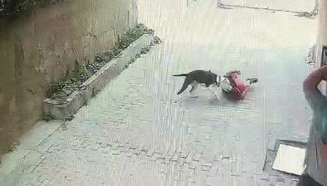 Ataşehir’de pitbull çocuğa saldırdı Ataşehir’de pitbull çocuğa saldırdı