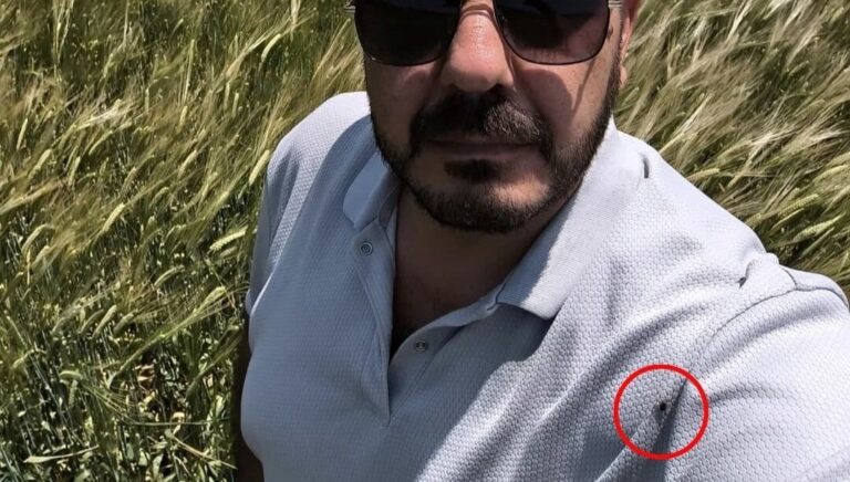 Hayat kurtaran selfie: Çektiği fotoğrafta keneyi fark etti Hayat kurtaran selfie: Çektiği fotoğrafta keneyi fark etti