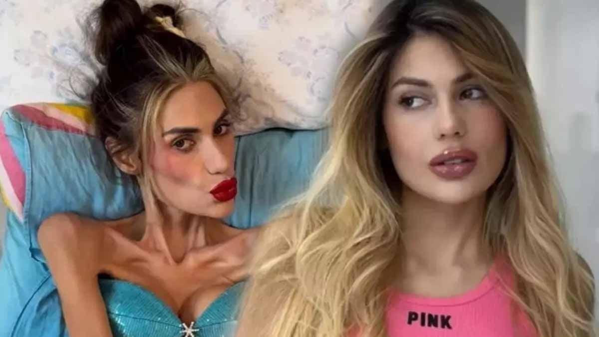 Tedavi altındaydı ama kurtarılamadı! Anoreksiya neden bu kadar ölümcül? Tedavi altındaydı ama kurtarılamadı! Anoreksiya neden bu kadar ölümcül?