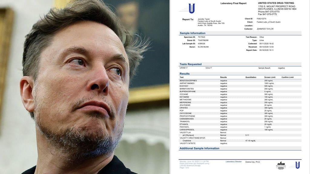 Uyuşturucu kullandığı iddalarında sonra Elon Musk, idrar testini paylaştı Uyuşturucu kullandığı iddalarında sonra Elon Musk, idrar testini paylaştı