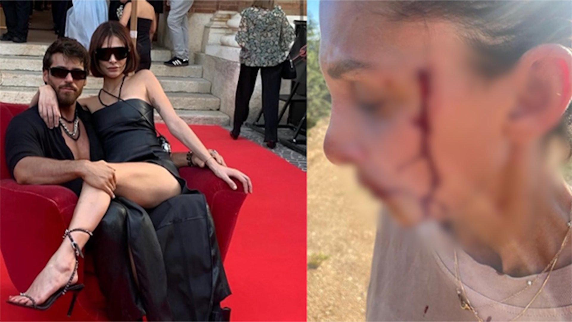 Can Yaman’ın sevgilisi kanlar içinde paylaşım yaptı: Şiddet görüyorum Can Yaman’ın sevgilisi kanlar içinde paylaşım yaptı: Şiddet görüyorum