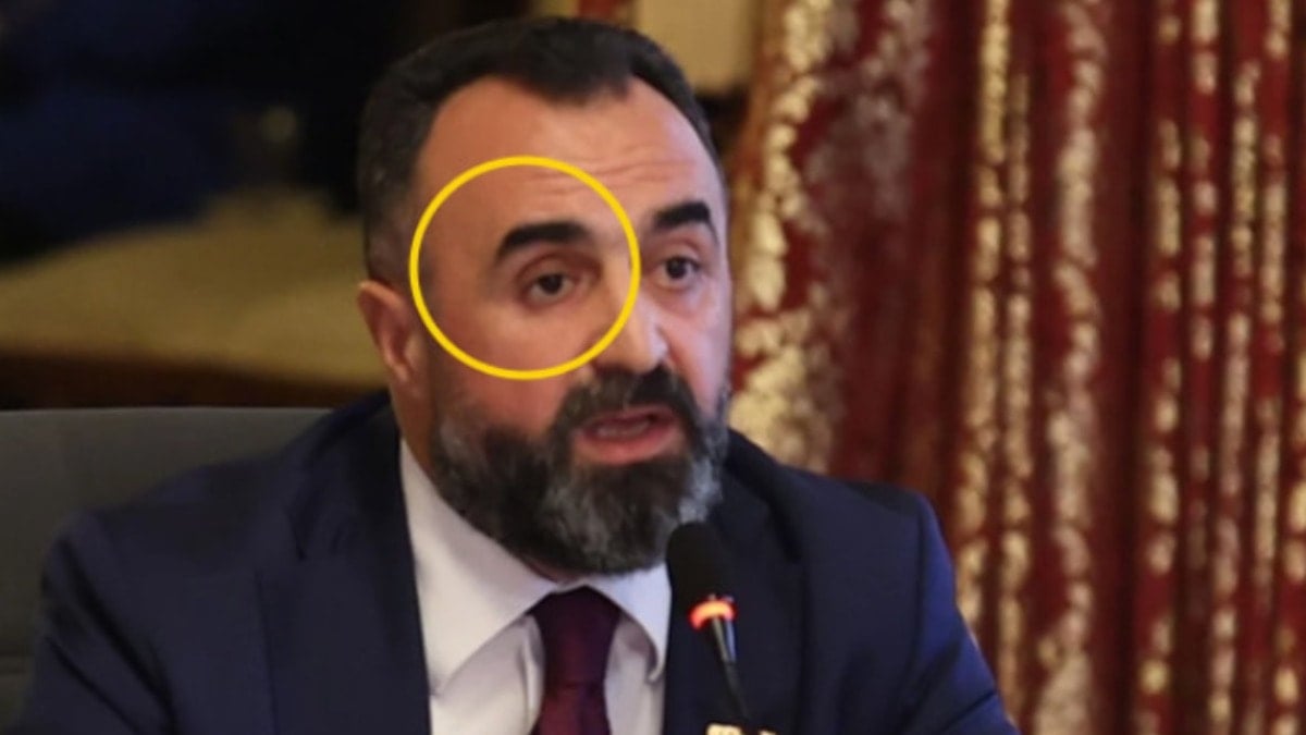 Sağ gözünü eline aldı, vekiller dondu kaldı! Sağ gözünü eline aldı, vekiller dondu kaldı!